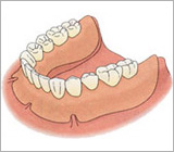 総入れ歯